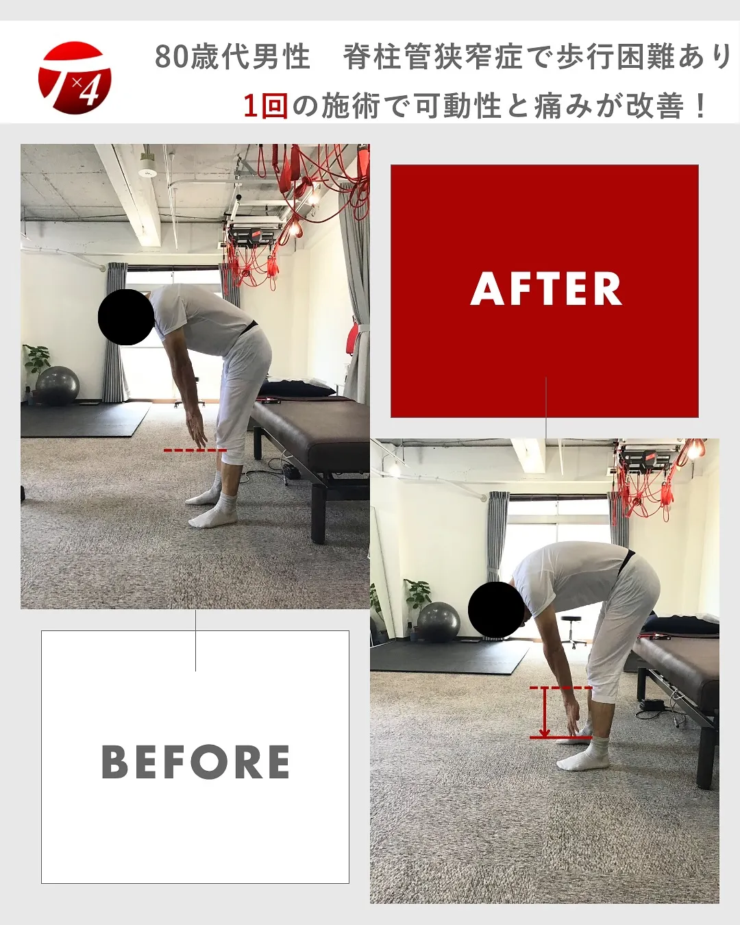 【ビフォーアフター　①】