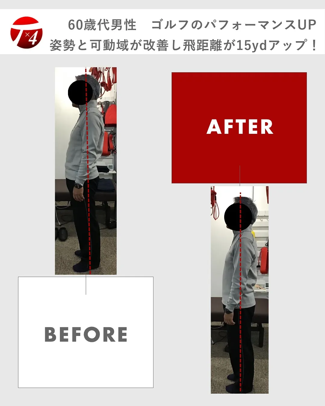 【ビフォーアフター　③】