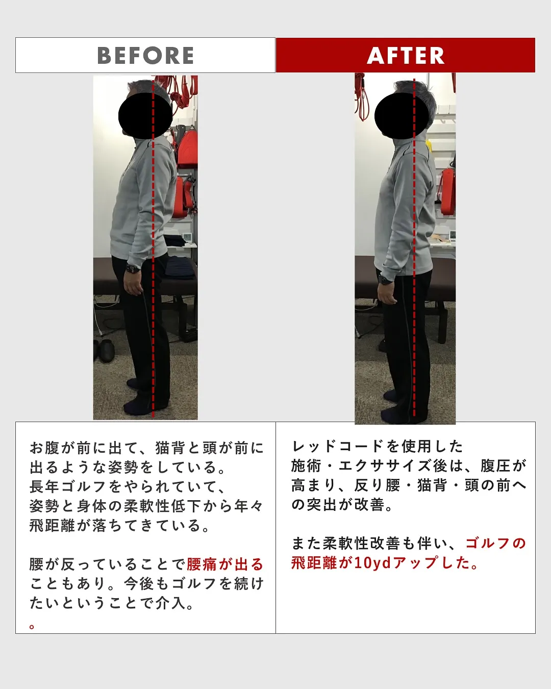 【ビフォーアフター　③】