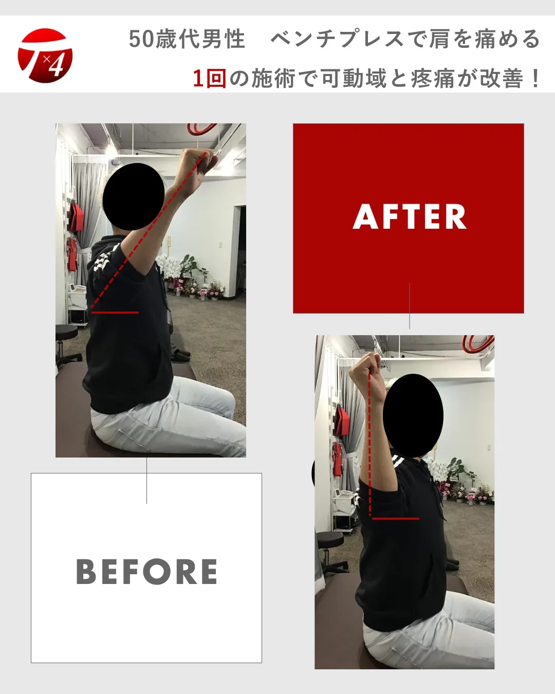 【ビフォーアフター ④】