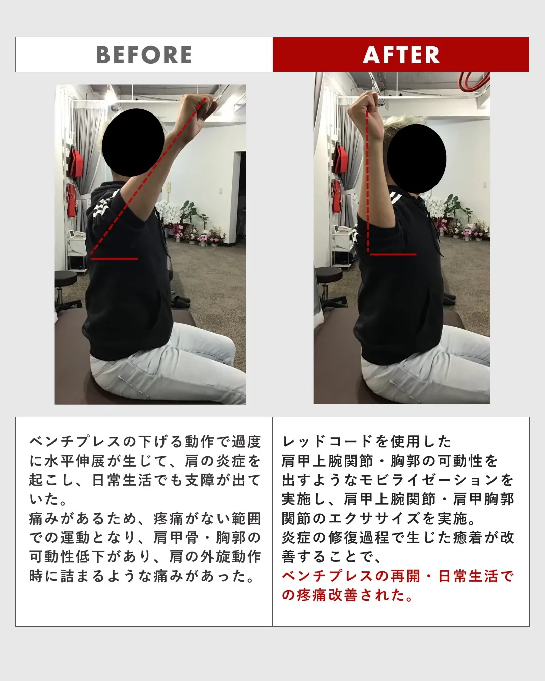 【ビフォーアフター ④】