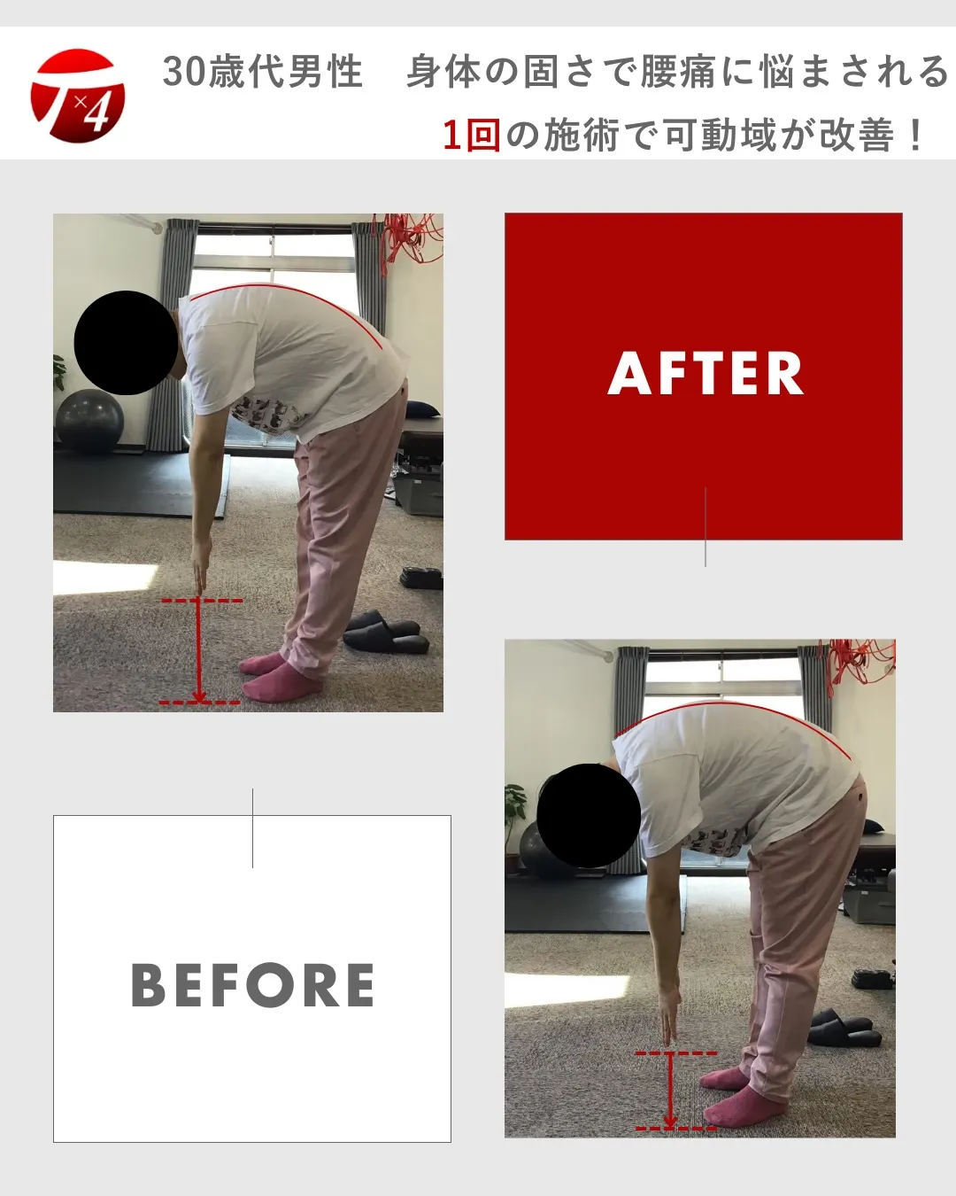 【ビフォーアフター　⑧】