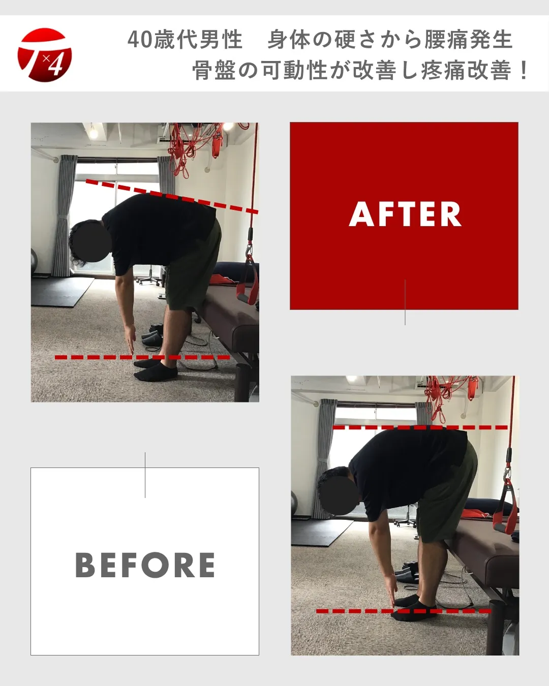 【ビフォーアフター　11】