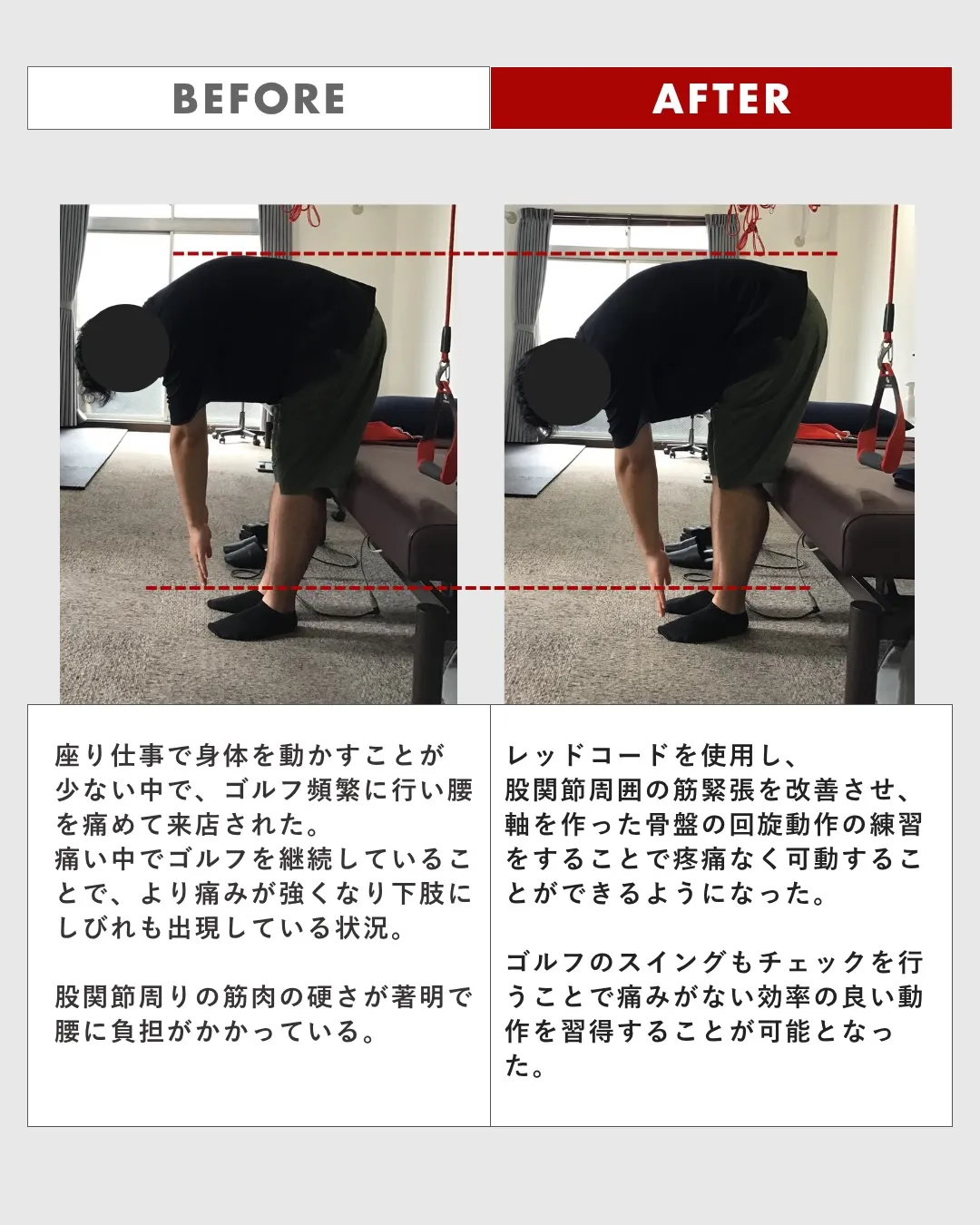 【ビフォーアフター　11】