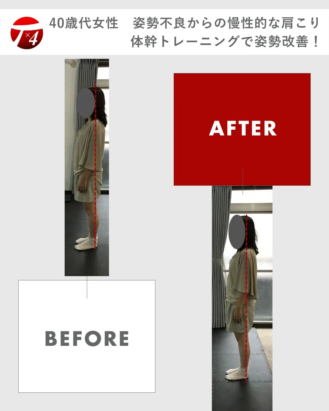 【ビフォーアフター　13】